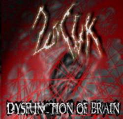2nCuk : Dysfunction of Brain
